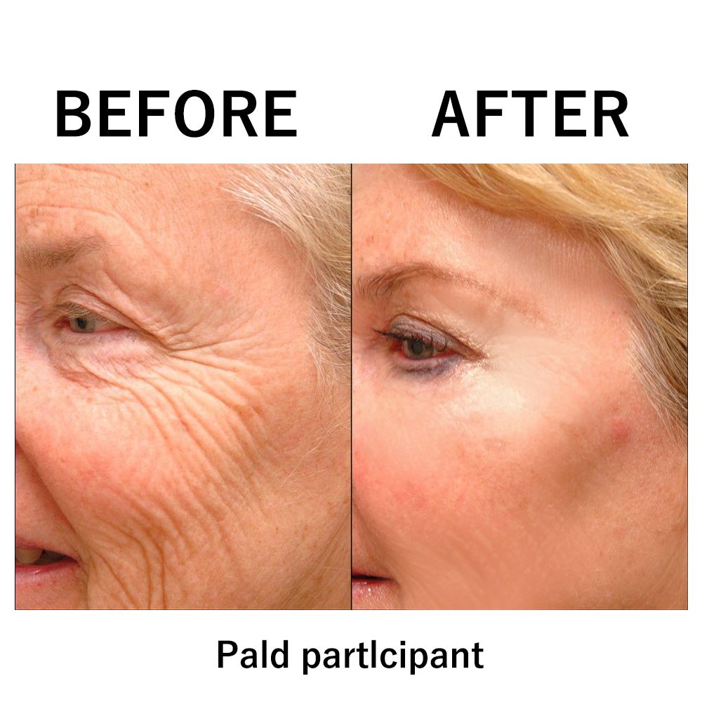 🌸Instant Temporary Face Tightener
